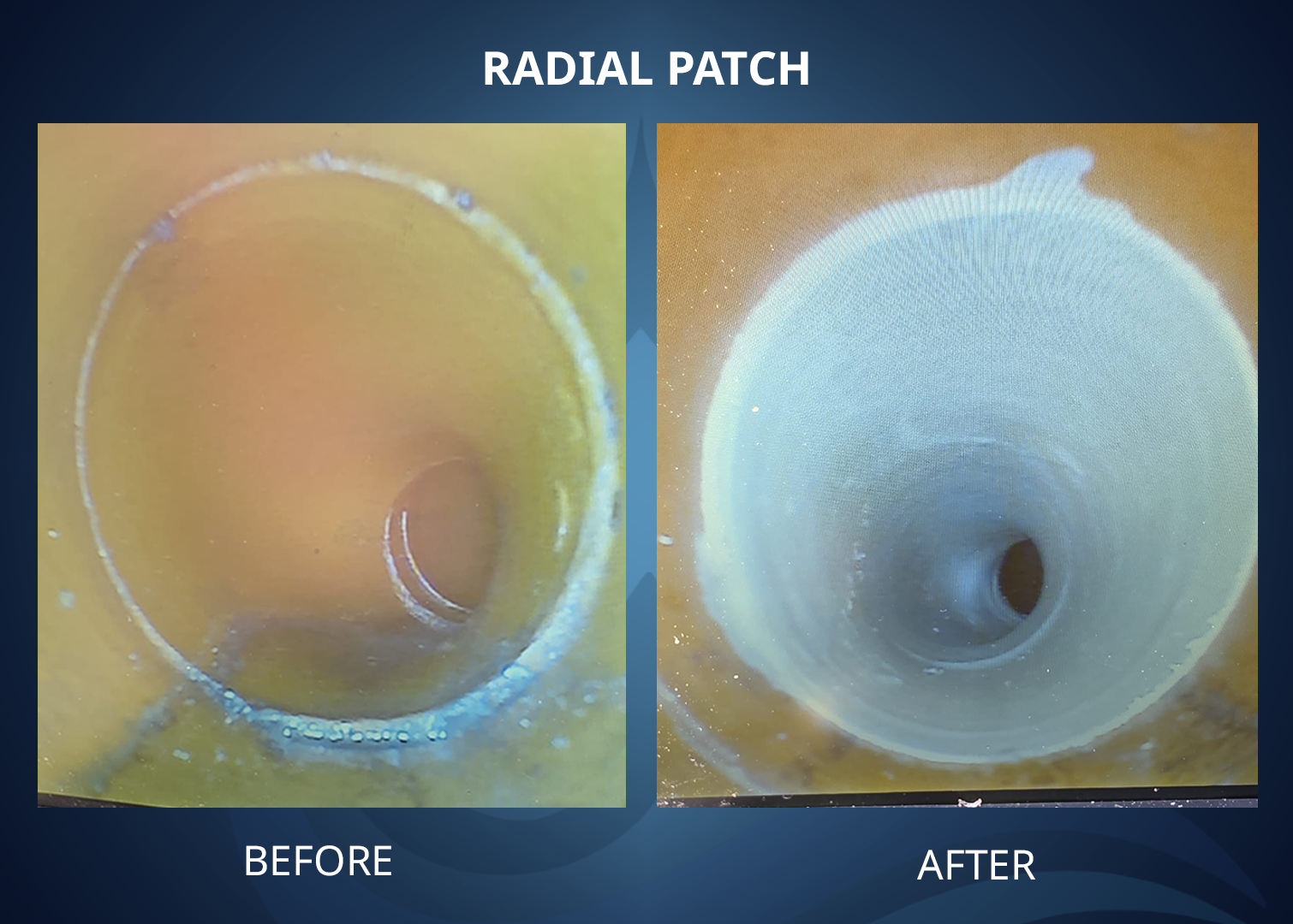 before-after-radial-patch-5
